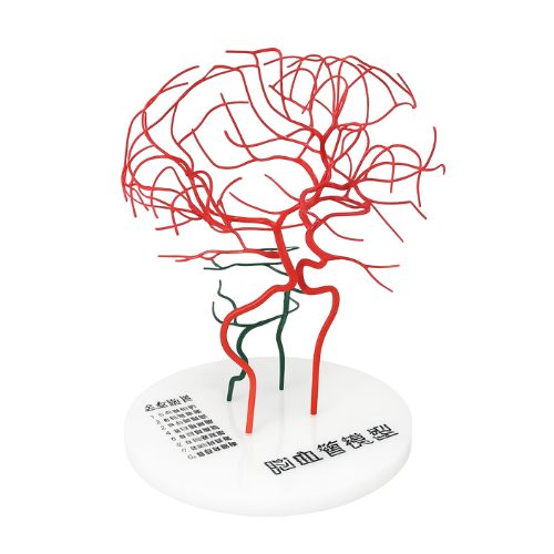 脳内血管模型3D